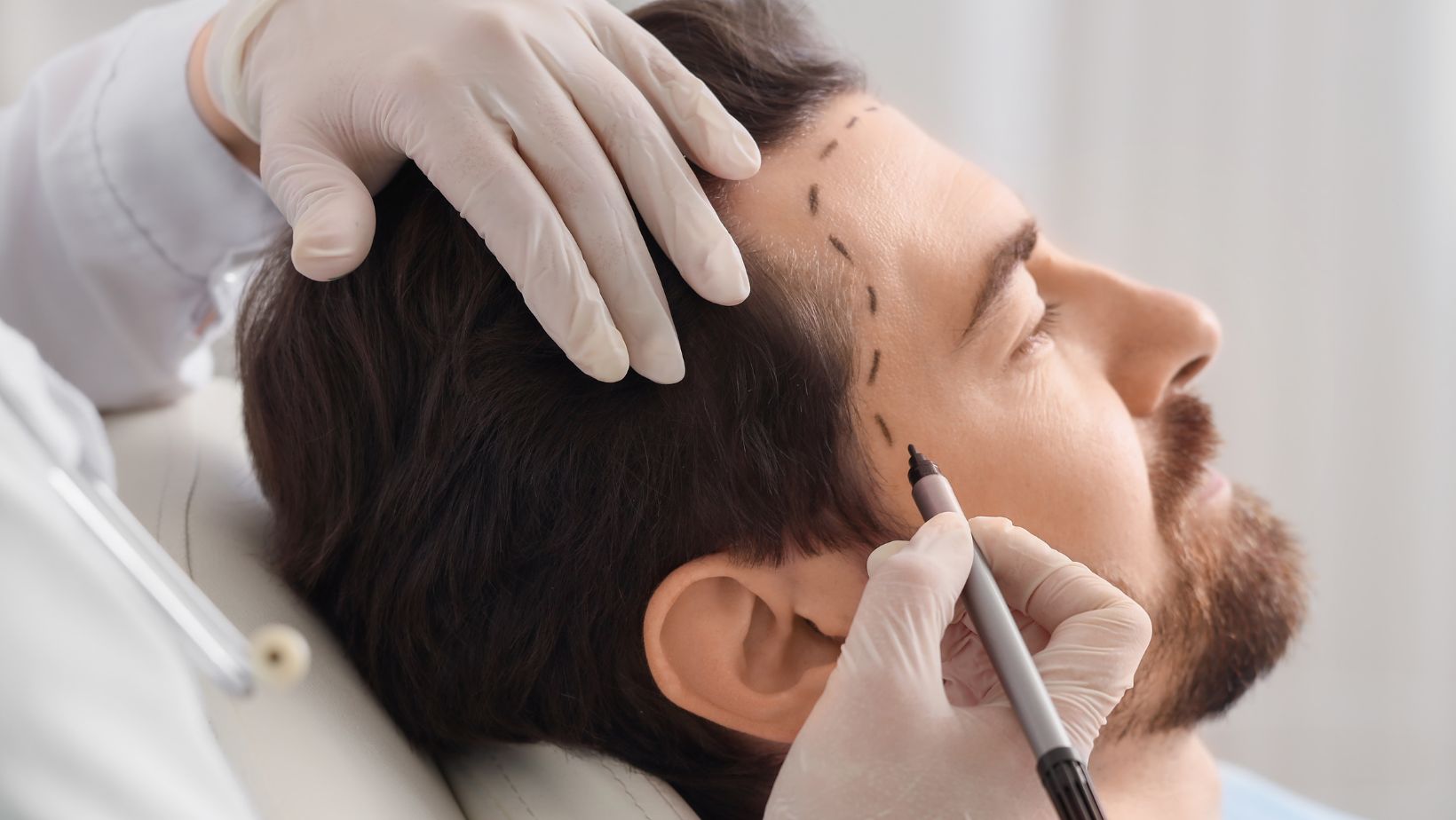 The perfect places in istanbul to recover after an afro hair transplant